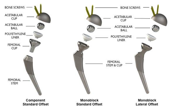 Hip Replacement Systems